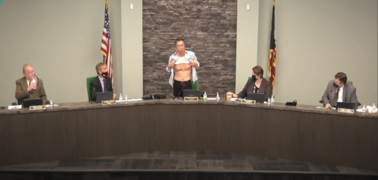 This is a picture of a man lifting his shirt to reveal a set of scars in front of a group of peers at what appears to be a scheduled political/committee meeting. 